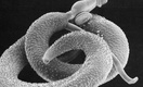 10 мифов из жизни глистов, или Как защититься от паразитарных заболеваний
