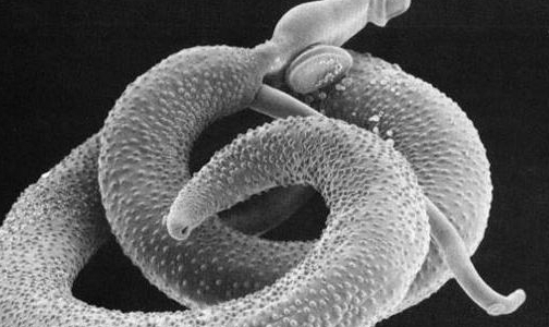10 мифов из жизни глистов, или Как защититься от паразитарных заболеваний