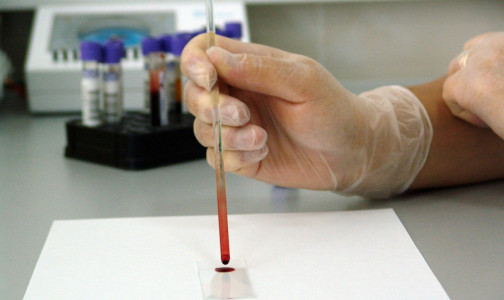 Итальянские ученые исследовали «осеннюю кровь» пациентов и считают, что коронавирус пришел в Европу до пандемии