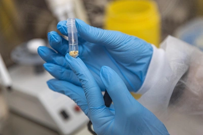 В Новосибирской области активизировались клещи