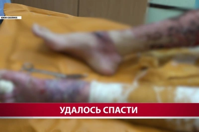 Житель Охи выжил после падения в колодец с кипятком