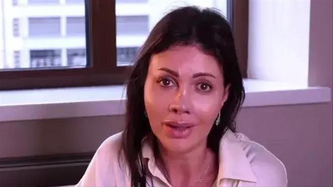 Алиса Казьмина о реакции людей на ее новую внешность: «У ассистентки были слезы, а врач перекрестился»