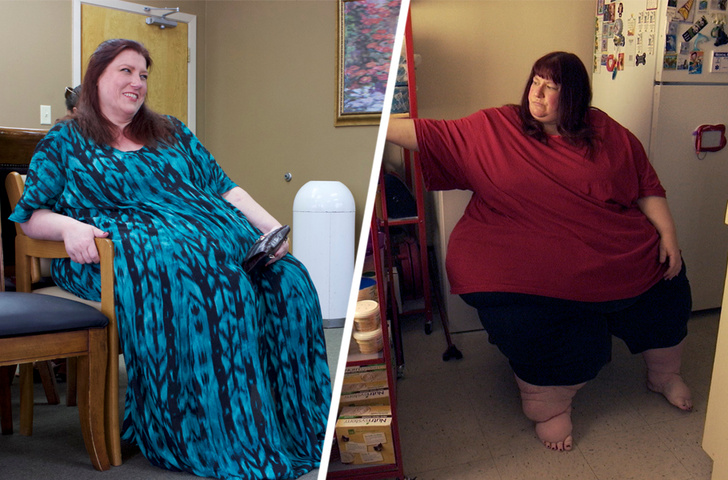 «До и после»: как выглядят люди, похудевшие на 150 кг и больше