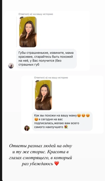 Мнение интернет-пользователей на счет внешнего вида Анны очень разнится