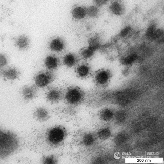 «Вектор» показал первые фото дельта-штамма коронавируса