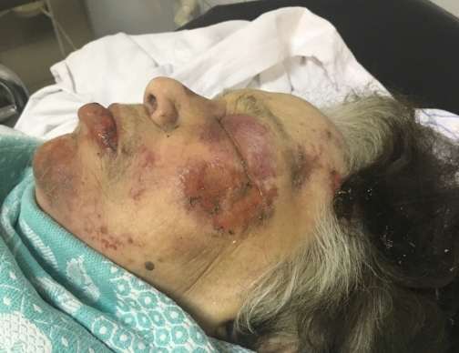 Заблудившаяся в НИИ Джанелидзе петербурженка два дня пролежала в подвале без сознания
