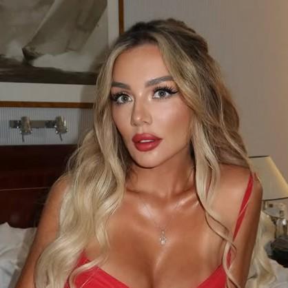 Отекшая и большая: как выглядит Анна Седокова на чужой странице в соцсети