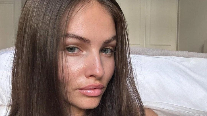 Какой стала самая красивая девочка в мире, которую раньше обожали все: 20 честных фото | Источник: соцсети