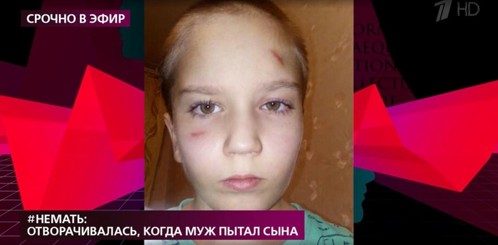 Мать изувеченного 8-летнего мальчика рассказала, как покорно выходила из комнаты, когда муж бил ее сына