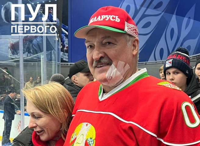 Лукашенко получил рассечение подбородка во время хоккейного матча | ya62.ru