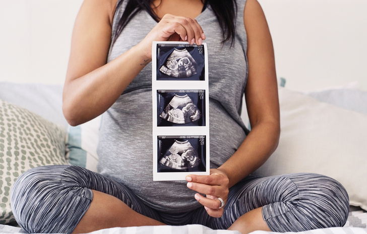 УЗИ беременным: сколько делать, чтобы не навредить