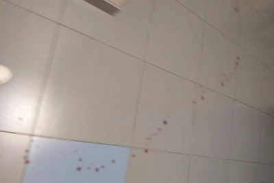 Nizhnekamsk Authorities Assess Lyceum's Actions After Teen Stabbing