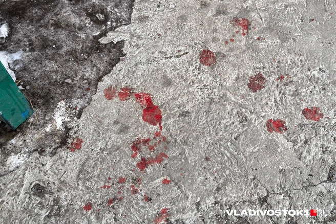 Мальчику наложили косметические швы | Источник: Елена Буйвол / VLADIVOSTOK1.RU