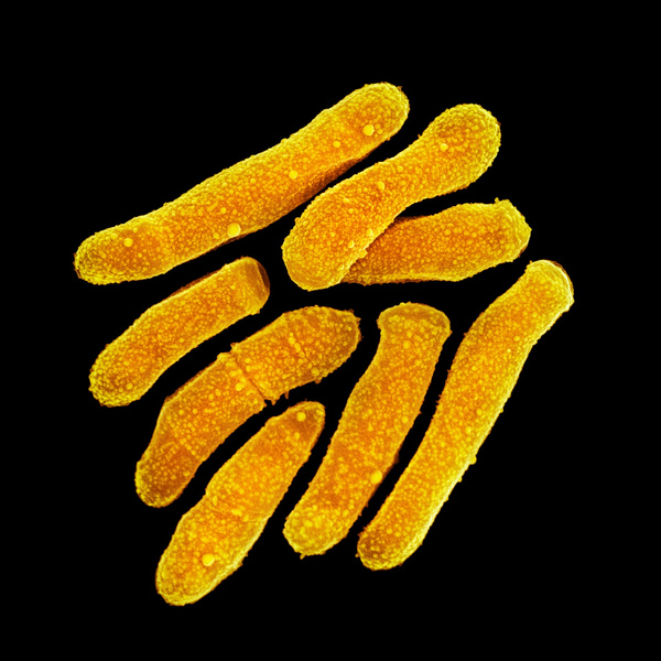 Пропионибактерии