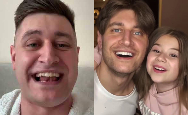 Что делали с зубами Бузова, Тимати и другие российские звезды: фото до и после