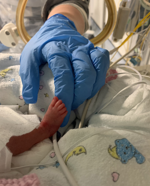 Девочка, родившаяся на 3 месяца раньше срока, была спасена с помощью целлофановых пакетов