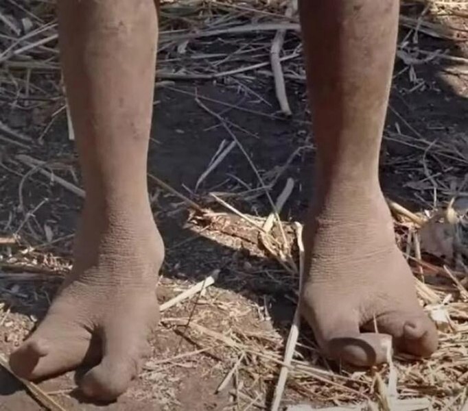 Как выглядят дети из африканского племени со страусиными ногами — фото
