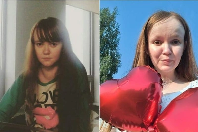 Perm Charity Helps Woman With Rare Moyamoya Disease