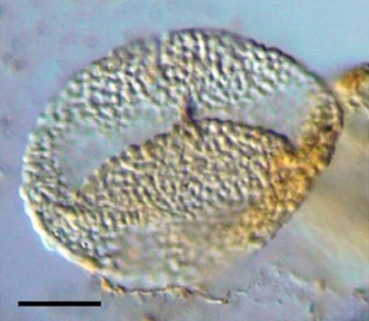 Пыльцевое зерно возрастом более 240 млн лет | Источник:  Hochuli PA and Feist-Burkhardt S.