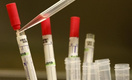 ВОЗ одобрила применение вакцины от лихорадки Эбола без завершения клинических испытаний