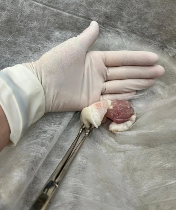 Кусок мяса был внушительных размеров | Источник: Балаковская клиническая больница