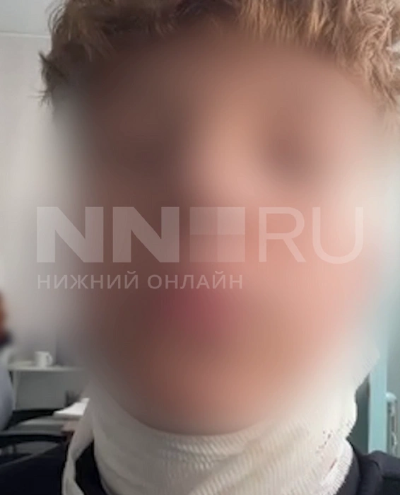 Один из пострадавших вчера опубликовал видео и показал перевязку | Источник: NN.RU