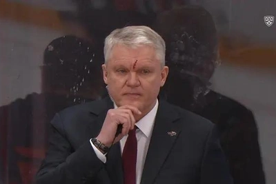 Тренер «Авангарда» получил травму шайбой в матче