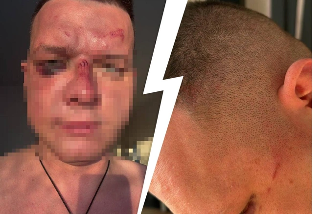 Встреча со старым другом закончился для Сергея госпитализацией | Источник: предоставил Сергей Койнов