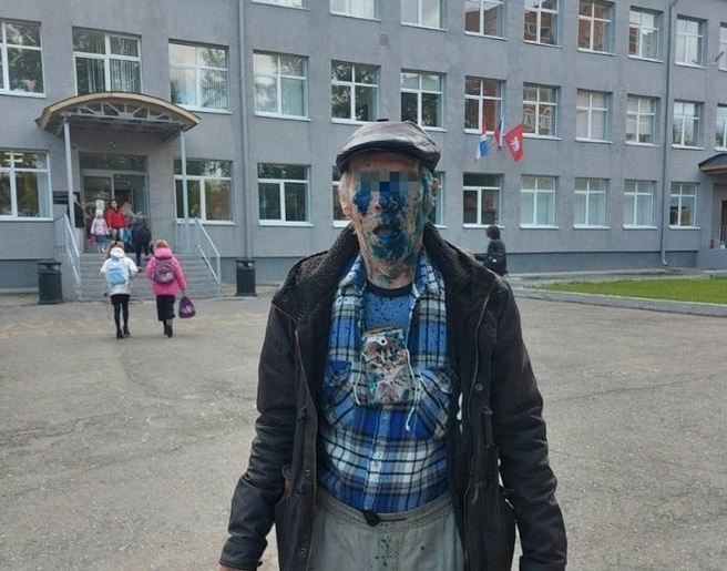 Пенсионеру нападавший выстрелил зеленкой в упор в лицо | Источник: читатель 59.RU