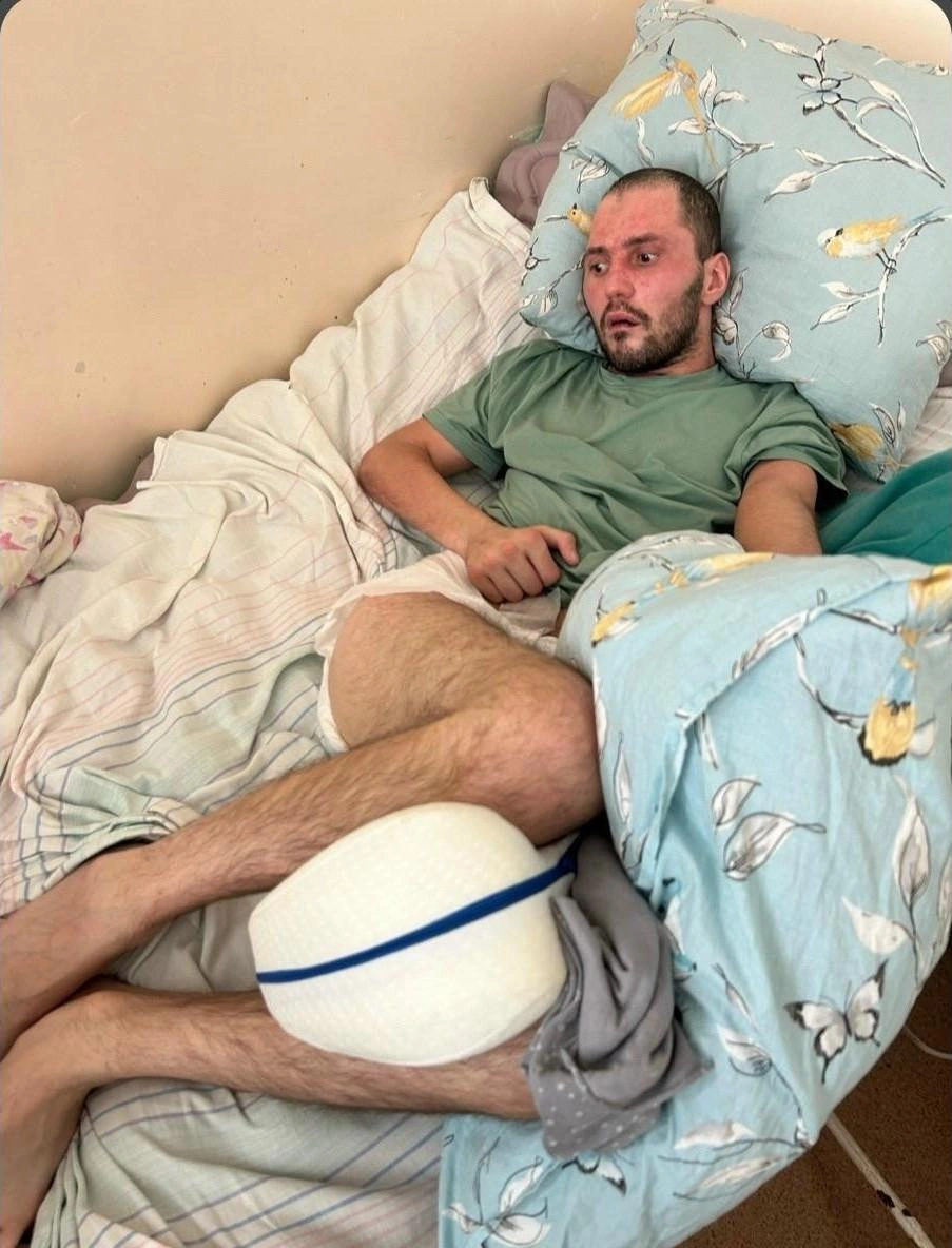 В таком состоянии Алексей находился в больнице | Источник: Антонина Греф / Vk.com