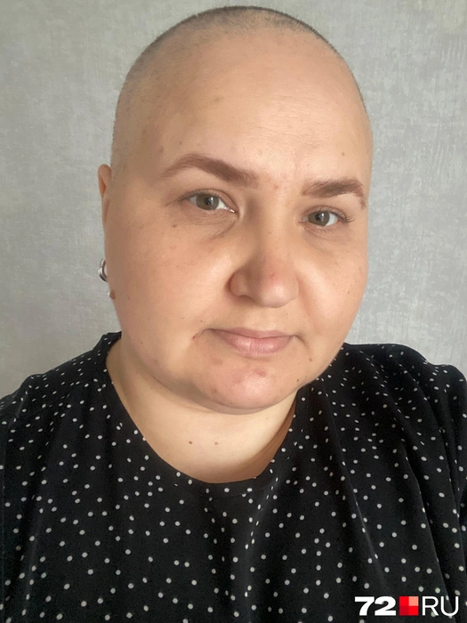 Тюменка говорит, что принять новую внешность было непросто. Муж в ее поддержку тоже сбрил волосы  | Источник: Александра Храмцова 