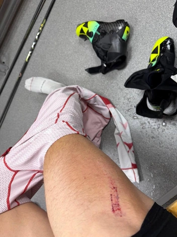 Источник: Sanya Bakurov / T.me