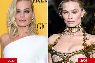 Марго Робби: натуральная красота или заслуга докторов?