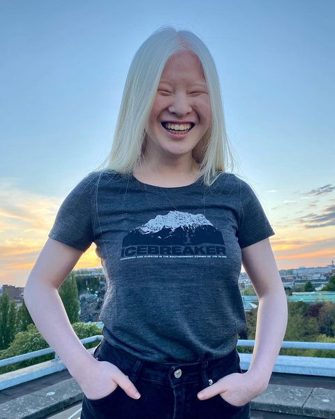 Девочку-альбиноса подкинули в детдом — она выросла и стала супермоделью