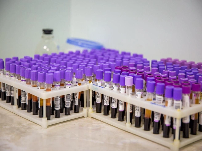 Ключевое значение имеет оценка уровня витамина D через анализ 25(ОН)D в сыворотке крови | Источник: Александр Ощепков / NGS.RU