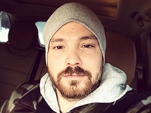 Алексей Чадов раскритиковал пластическую хирургию