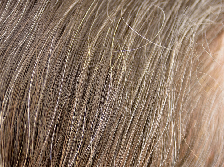 Почему волосы седеют из-за стресса, и как это предотвратить