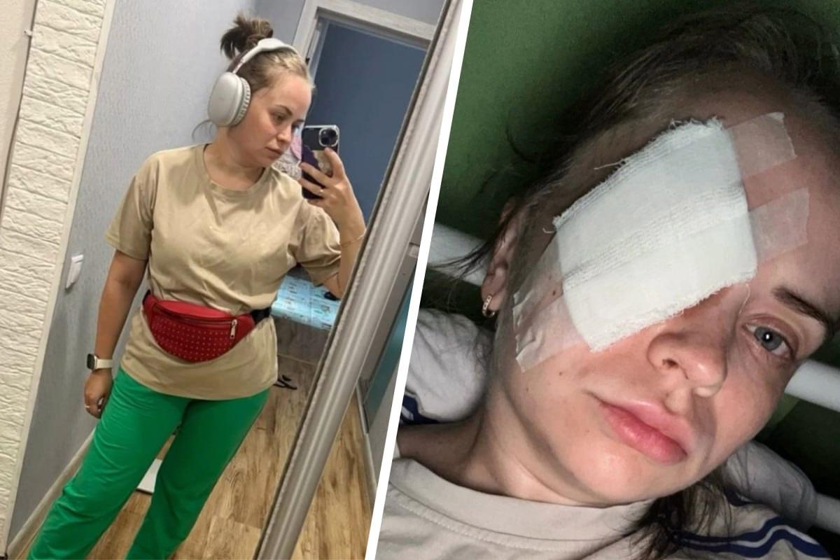 «Буду ли я видеть — загадка даже для врачей»: пермячка получила пулю в глаз во время пробежки