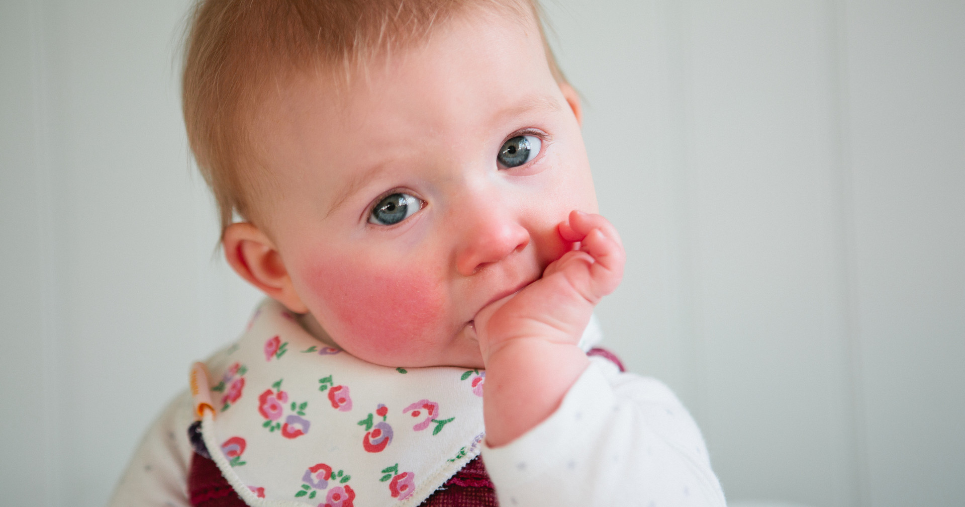 Ребенку год красные щеки. Пиуевая аллергия у ребёнка.