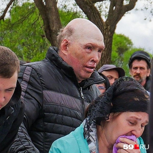 Мать и отец Нади. Мужчина получил ожоги около 11 лет назад, когда горел дом его семьи | Источник: Тимофей Калмаков / 59.RU