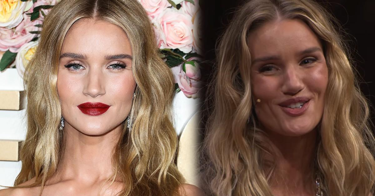 Последствия пластики или роковой укол ботокса: что так изменило лицо Роузи Хантингтон-Уайтли