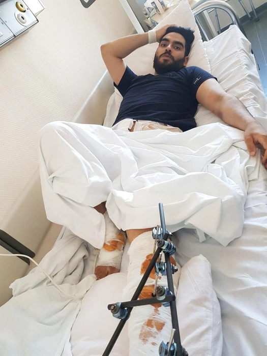 Студент проходил долгое лечение | Источник: личный архив Обайда Абдуллы