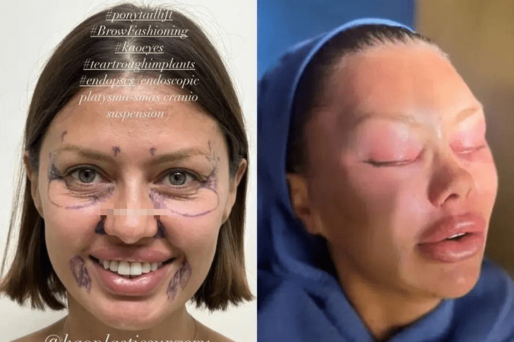 Виктория Боня впервые вышла в свет и показала свое лицо после операции