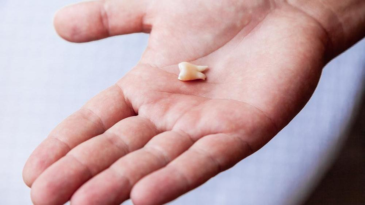 К чему снятся выпавшие зубы? Ученые нашли ответ!