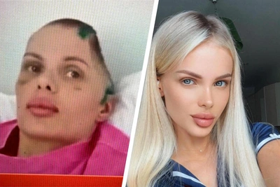 Анжелика Тартанова: год реабилитации после нападения