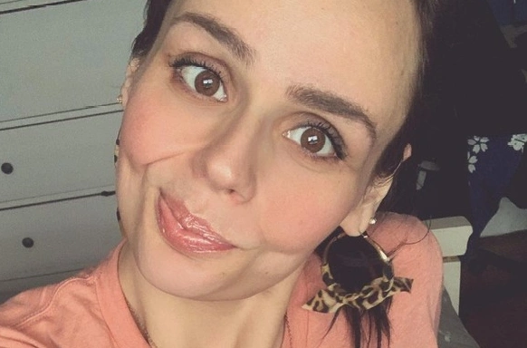 Аж заплакала! Девушка, похудевшая на 90 кг, увидела себя после удаления лишней кожи