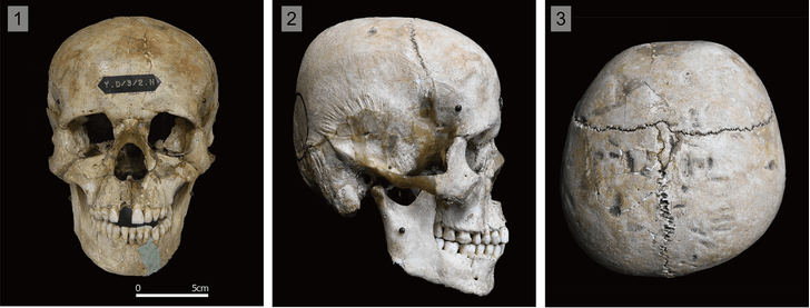 Плоские черепа: антропологи узнали жуткую подробность о древнем народе хирота