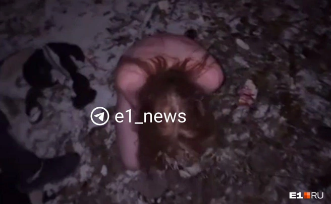 Всё лицо девушки было в крови | Источник: читатель E1.RU