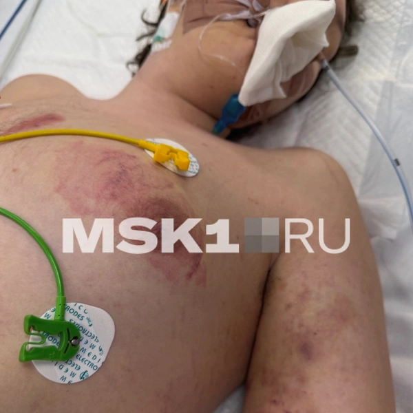 По словам Светланы, у сына были отбиты почки, в больнице он пережил остановку сердца | Источник: личный архив героини публикации 