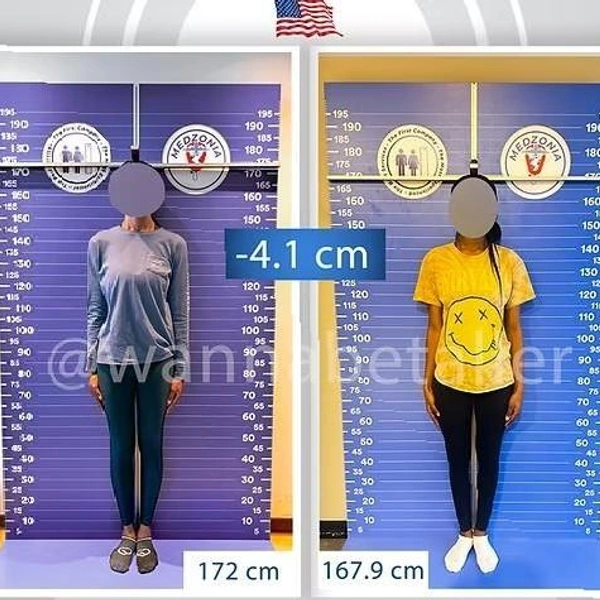 Источник: heightreduction.com
